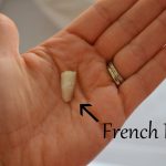 french fry stuck in nose french fry stuck in nose