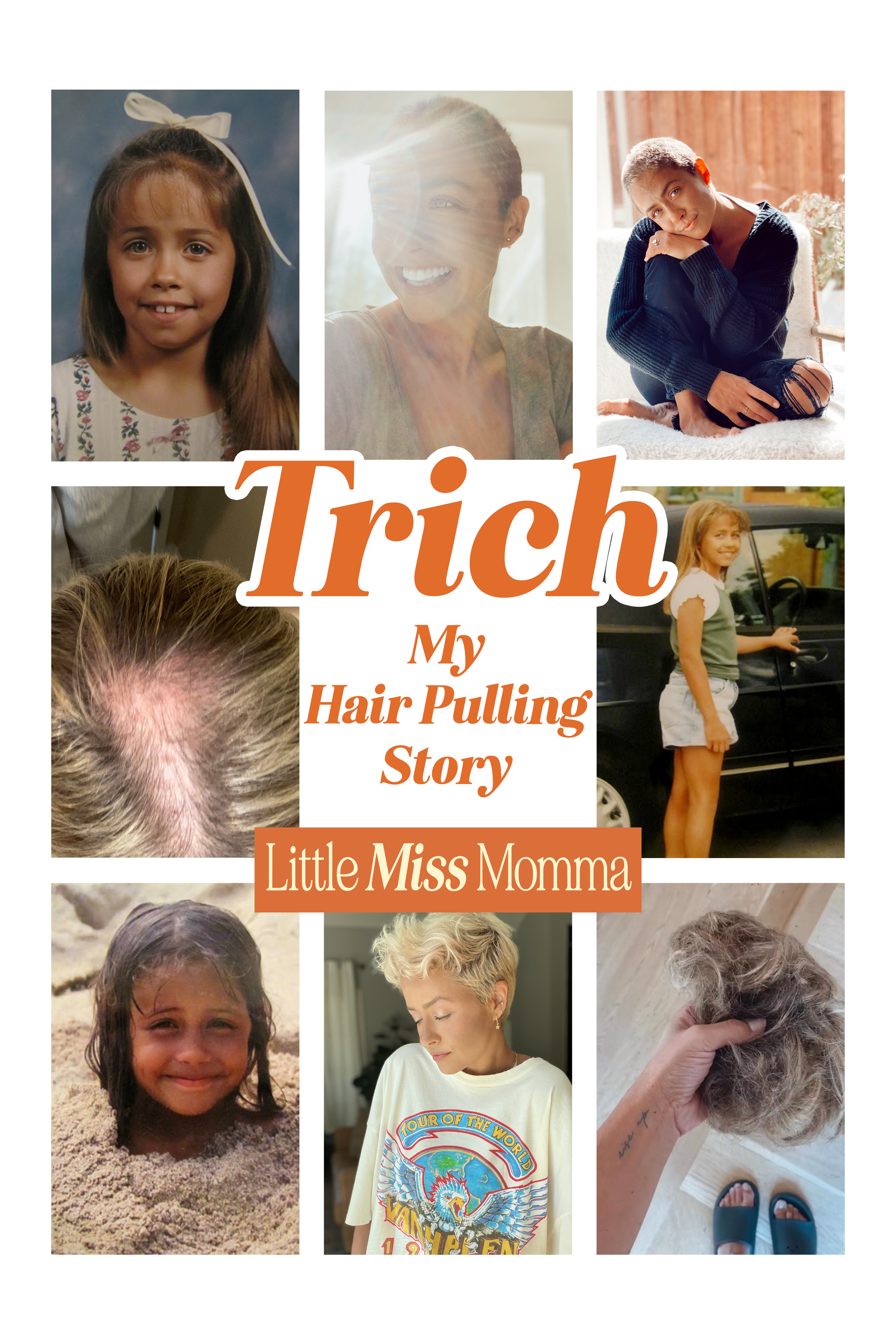 My Trichotillomania Hair Pulling Story (and resources) - grow, Life -  Little Miss Momma